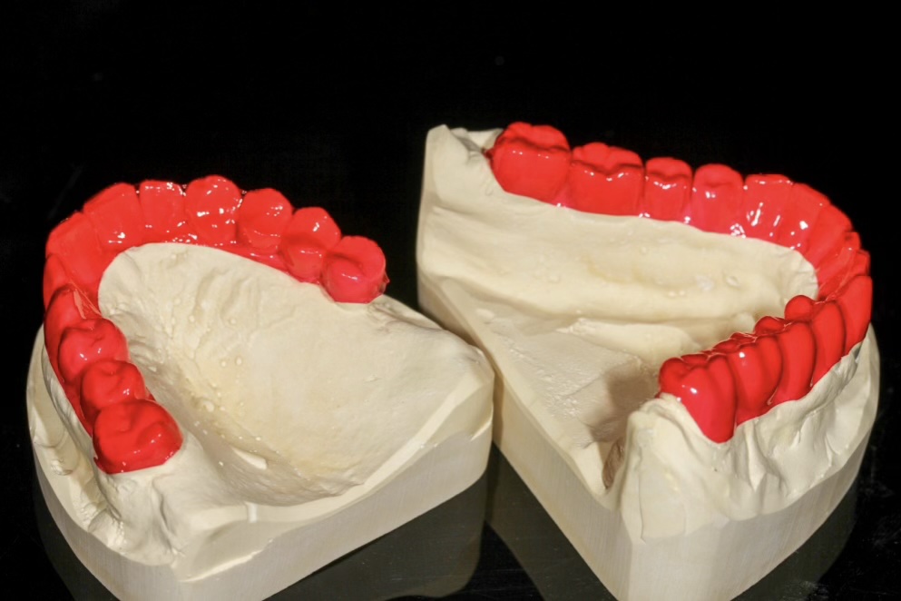 Bruxchecker zum Auffinden von Bewegungsmstern